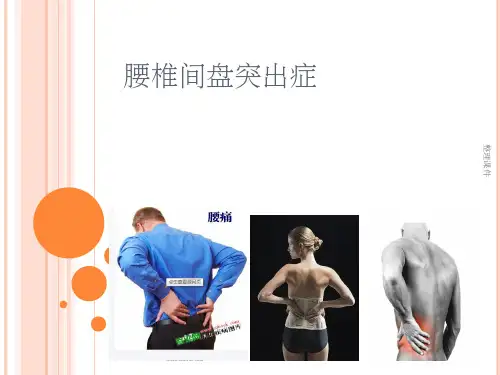 《腰椎间盘突出症》