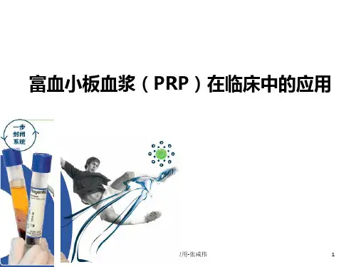 PRP的临床应用-张咸伟PPT课件