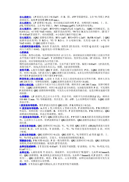 心电图知识点总结