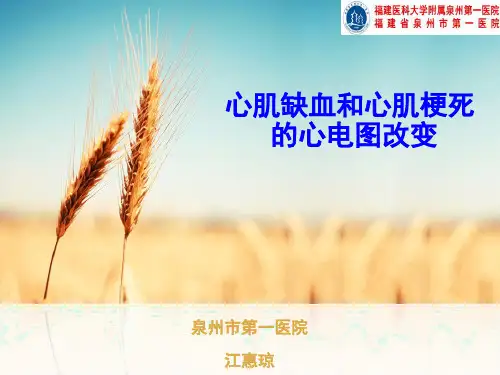 心肌缺血与心肌梗死心电图改变