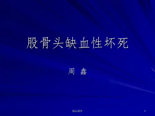成人股骨头缺血性坏死ppt课件