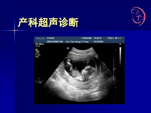 产科超声诊断(讲义)