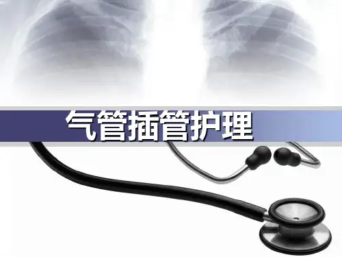 气管插管病人护理