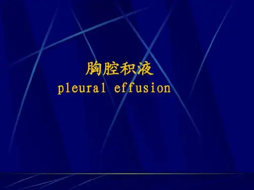 胸腔积液(最新修改)