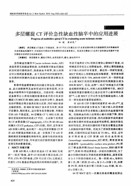 多层螺旋CT评价急性缺血性脑卒中的应用进展