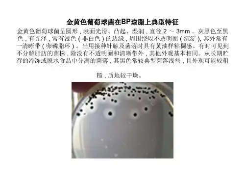 各菌菌落形态知识分享