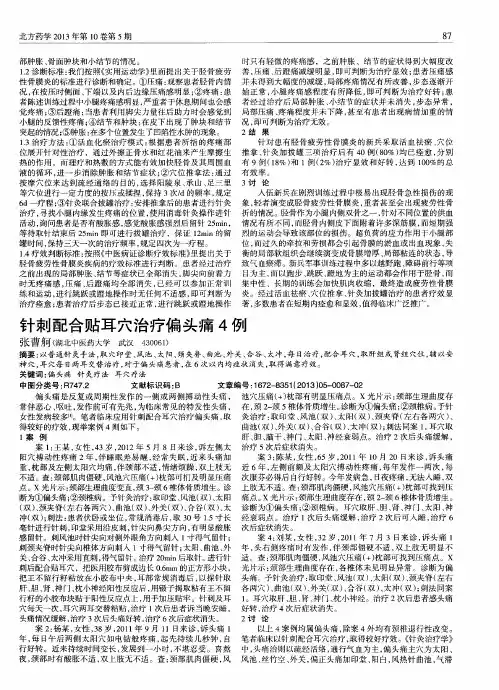 针刺配合贴耳穴治疗偏头痛4例