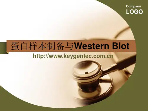 蛋白样本制备、定量及western步骤详解