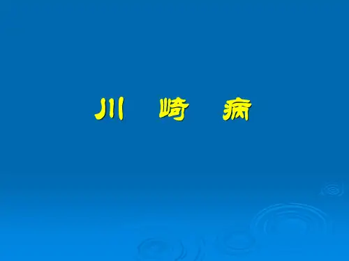 川崎病课件PPT