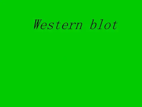 Western_blot_的由来,原理,步骤,帮你理解