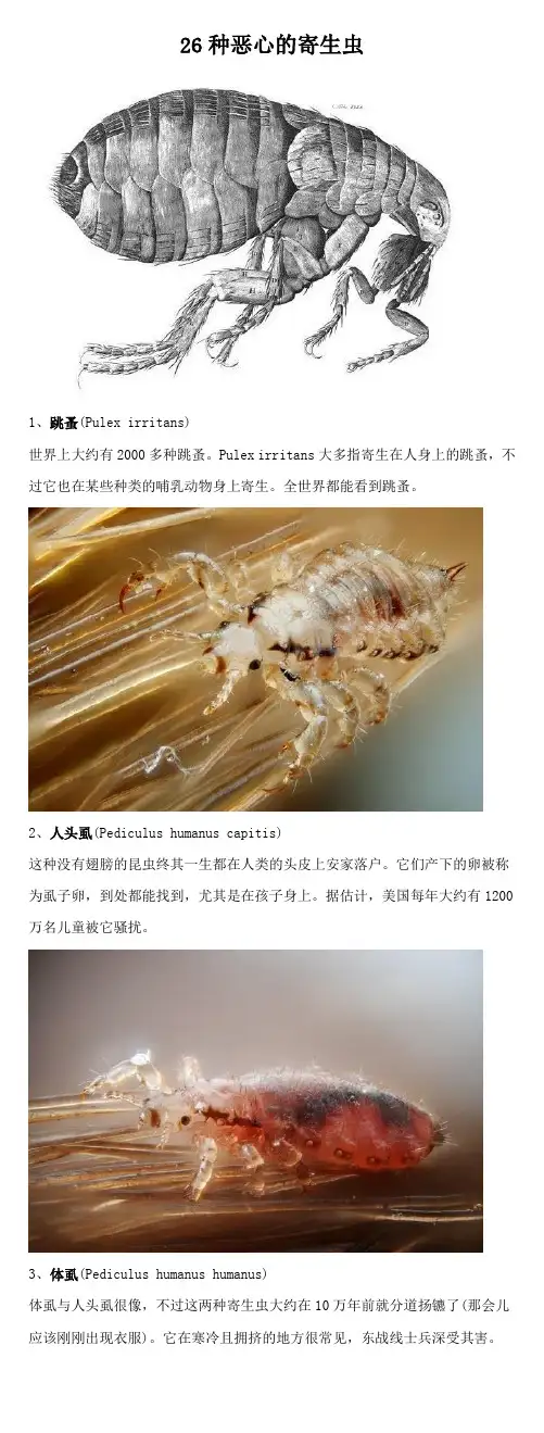 26种恶心的寄生虫