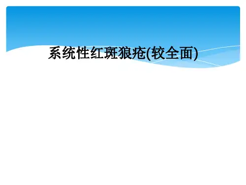 系统性红斑狼疮(较全面)
