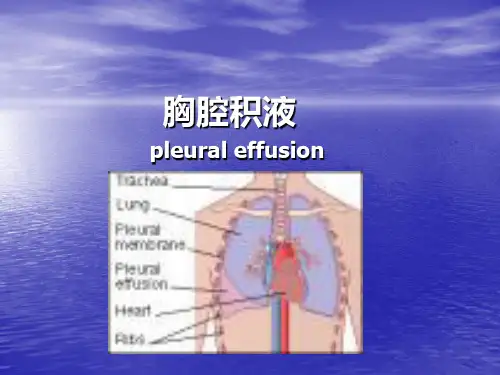 胸腔积液的定义