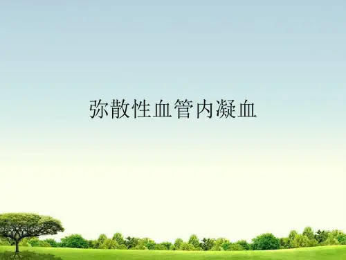 DIC弥散性血管内凝血 内科学课件