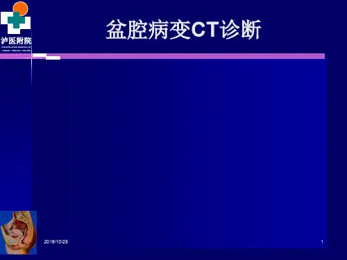 女性生殖系统疾病CT诊断