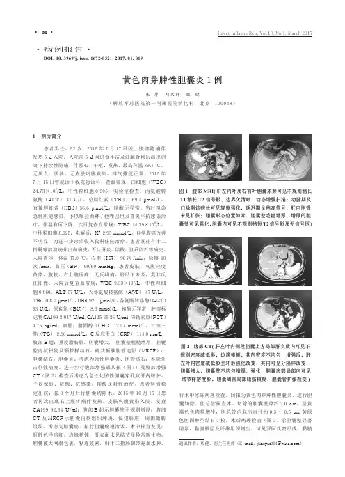 黄色肉芽肿性胆囊炎1例