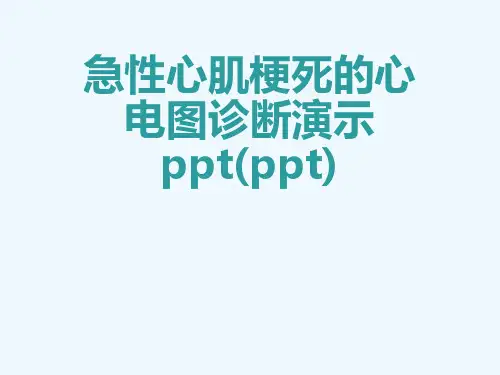 急性心肌梗死的心电图诊断演示ppt(ppt)