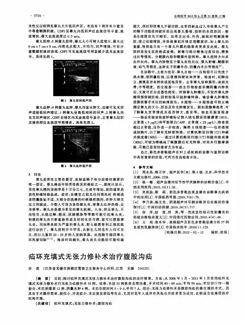 疝环充填式无张力修补术治疗腹股沟疝