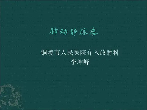 肺动静脉瘘1