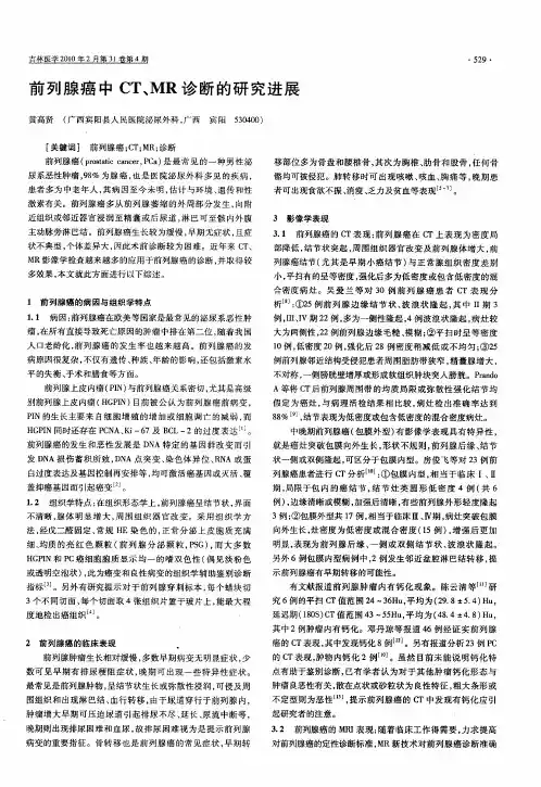 前列腺癌中CT、MR诊断的研究进展
