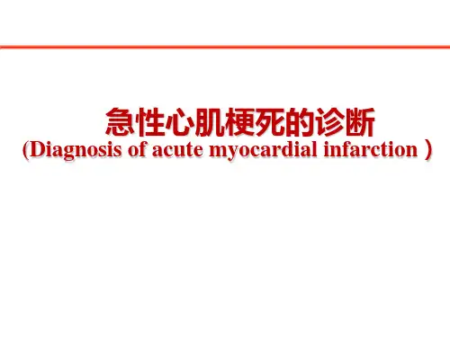 急性心肌梗死的诊断