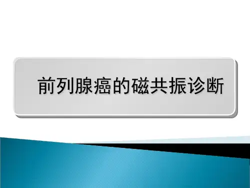 磁共振_前列腺癌 ppt课件