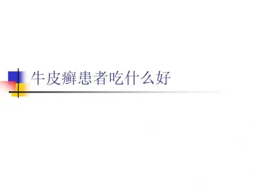 治疗牛皮癣吃什么好