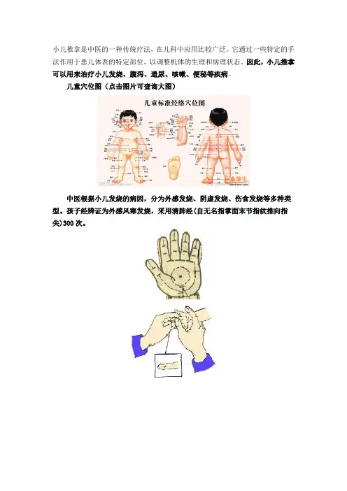 小儿推拿是中医的一种传统疗法
