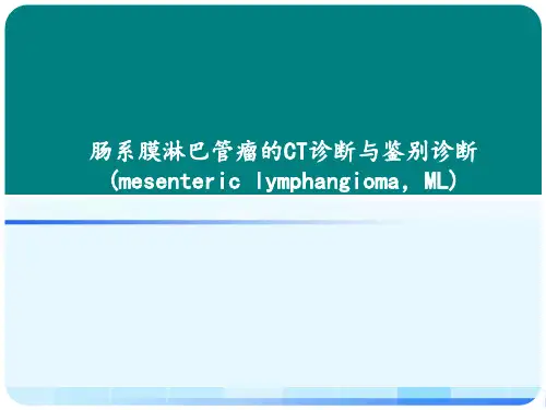 肠系膜淋巴管瘤的CT诊断与鉴别诊断