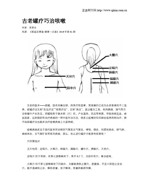 古老罐疗巧治咳嗽