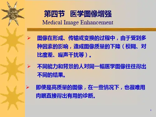 医学图象的增强原理