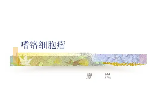 嗜铬细胞瘤