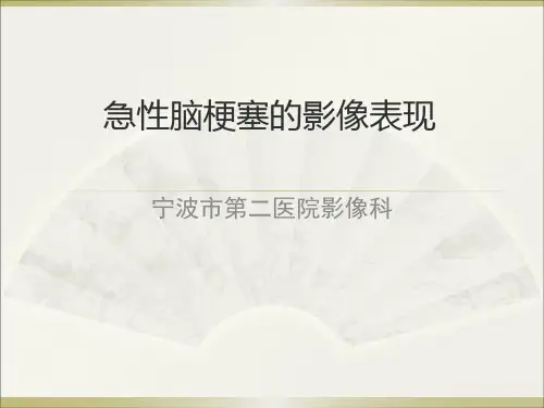 急性脑梗塞的影像诊断