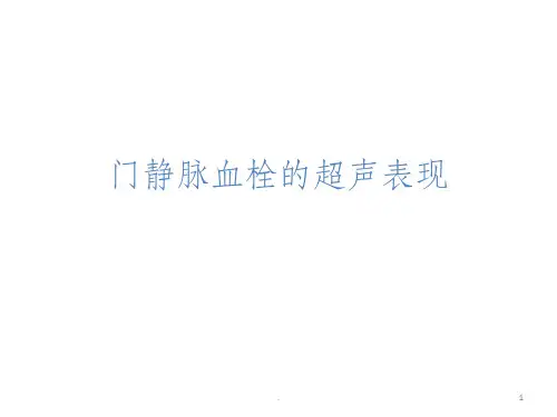 门静脉血栓