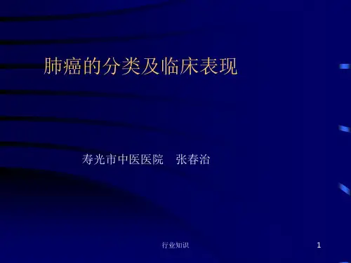 肺癌的分类及临床表现[荟萃知识]