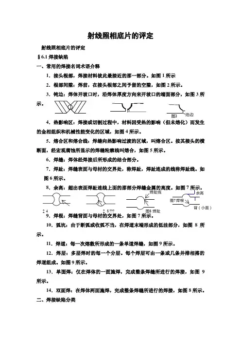 射线照相底片的评定1