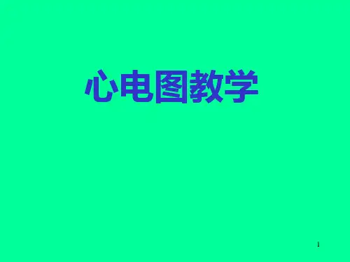 诊断学(实验)心电图教学PPT课件