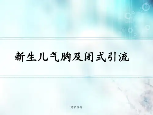 新生儿气胸胸腔穿刺及闭式引流