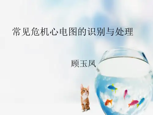 常见危机心电图及处理