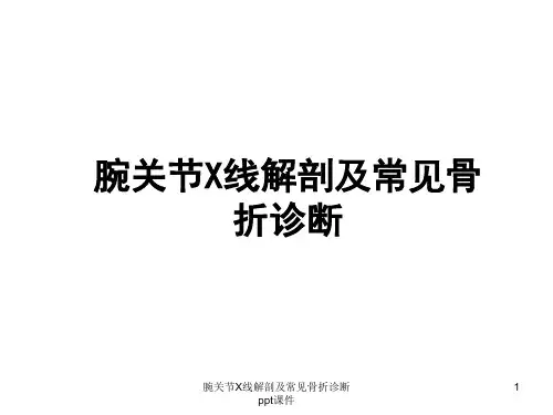 腕关节X线解剖及常见骨折诊断 ppt课件