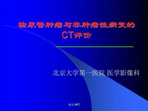 输尿管肿瘤与非肿瘤性病变的CT评价(精品课件)