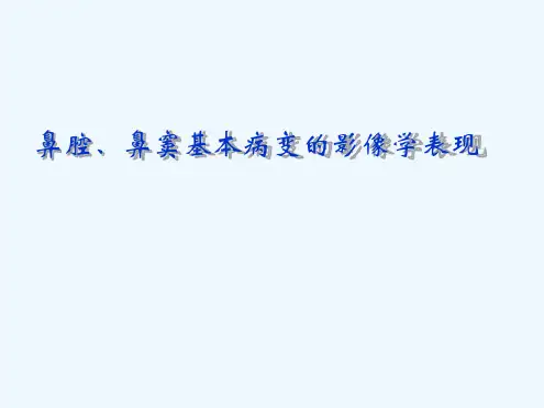 鼻腔鼻窦基本病变的影像学表现