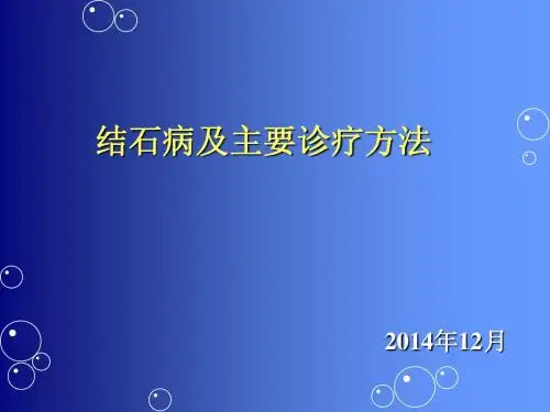 结石及主要诊疗方法