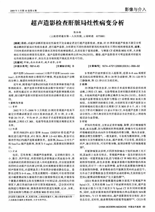 超声造影检查肝脏局灶性病变分析