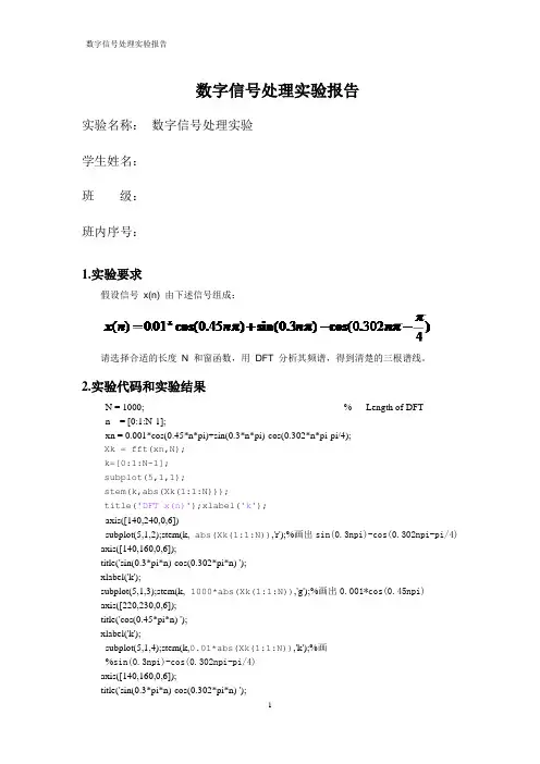 北京邮电大学_dsp_matlab实验报告