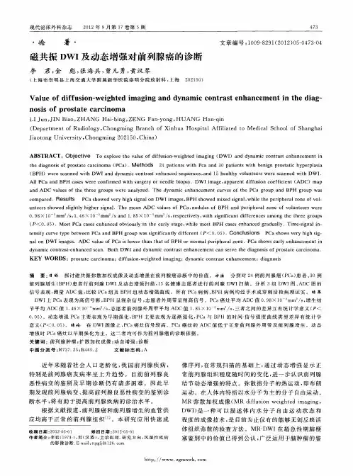 磁共振DWI及动态增强对前列腺癌的诊断