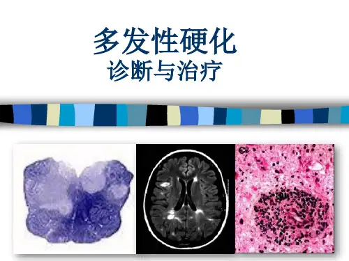 多发性硬化的诊断与治疗