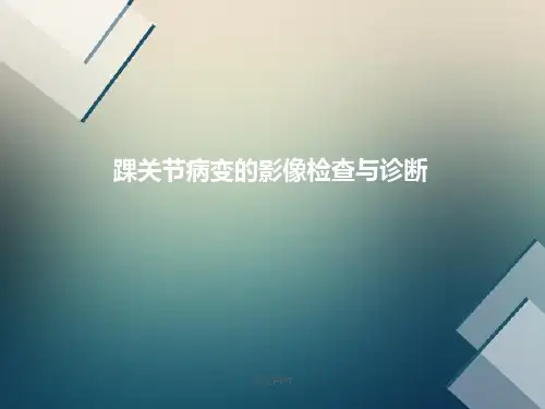 踝关节的影像诊断