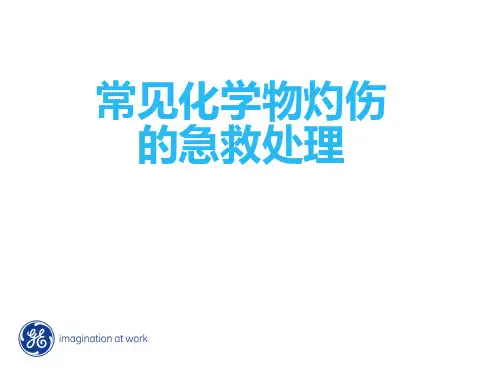 常见化学品灼伤的急救处理
