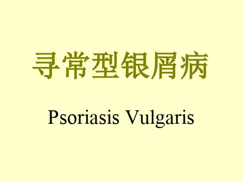 银屑病PPT课件(文库推荐)